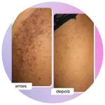 Virilhas